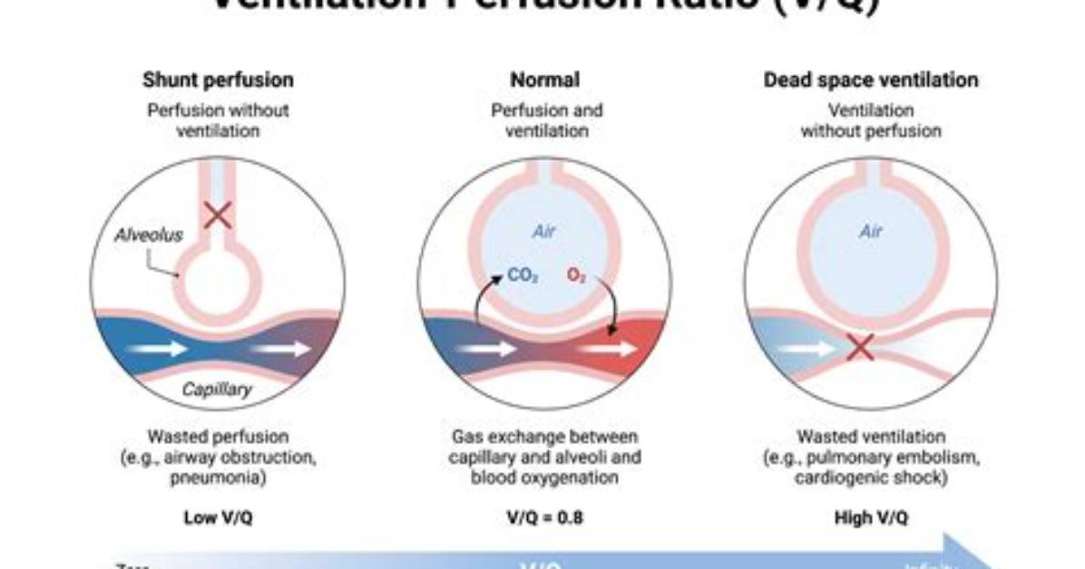 Can Ventilation Affect Perfusion?
