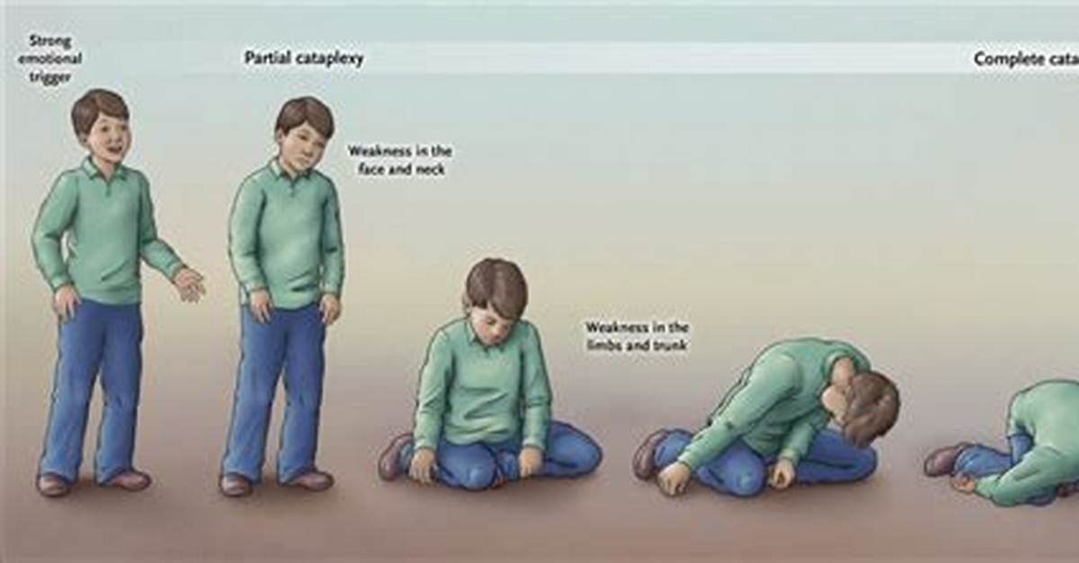 Can You Develop Cataplexy?