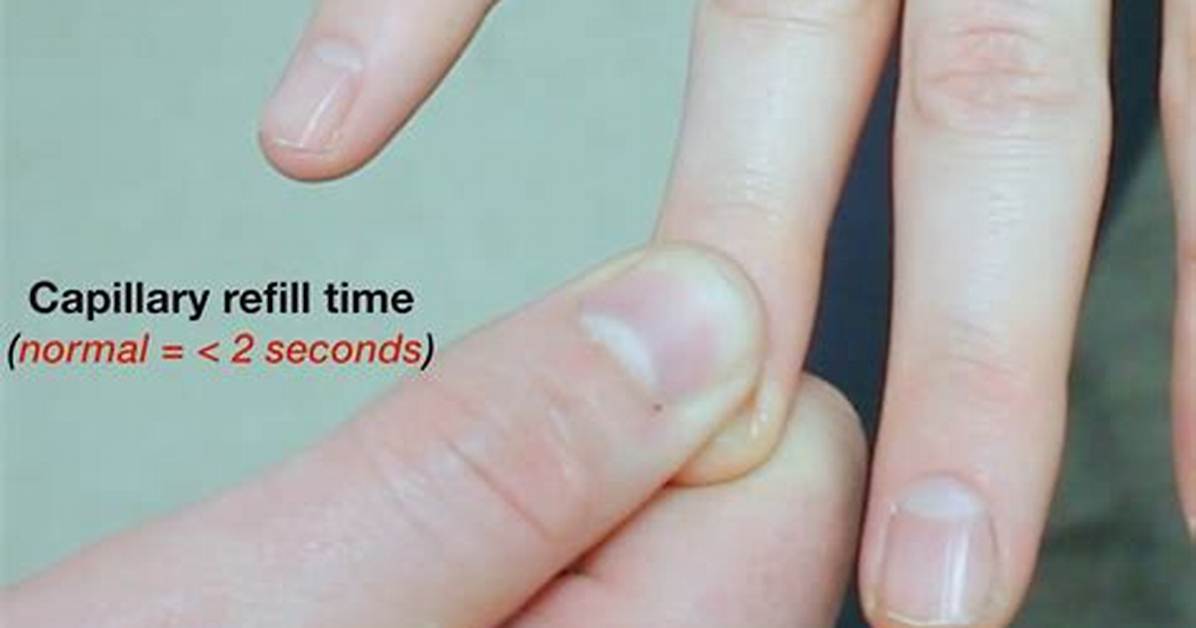 Capillary Refill Normal