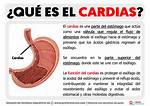 Cardias