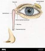 Caruncle Eye