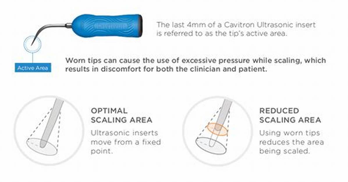 Cavitron Tips