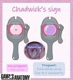 Chadwick Sign