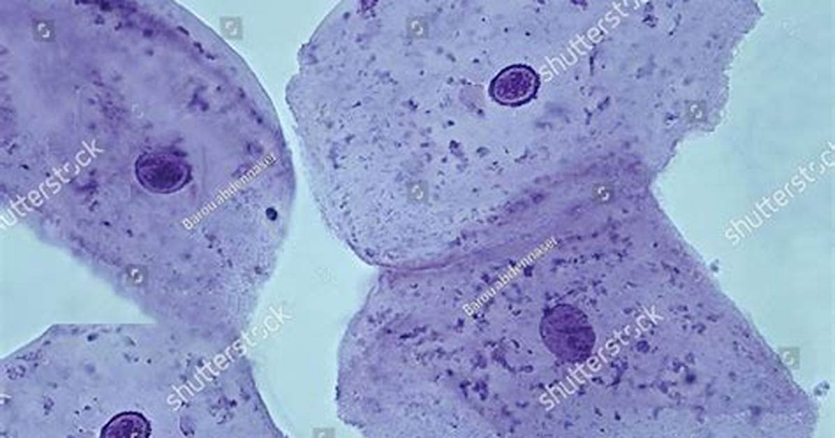 Cheek Cells