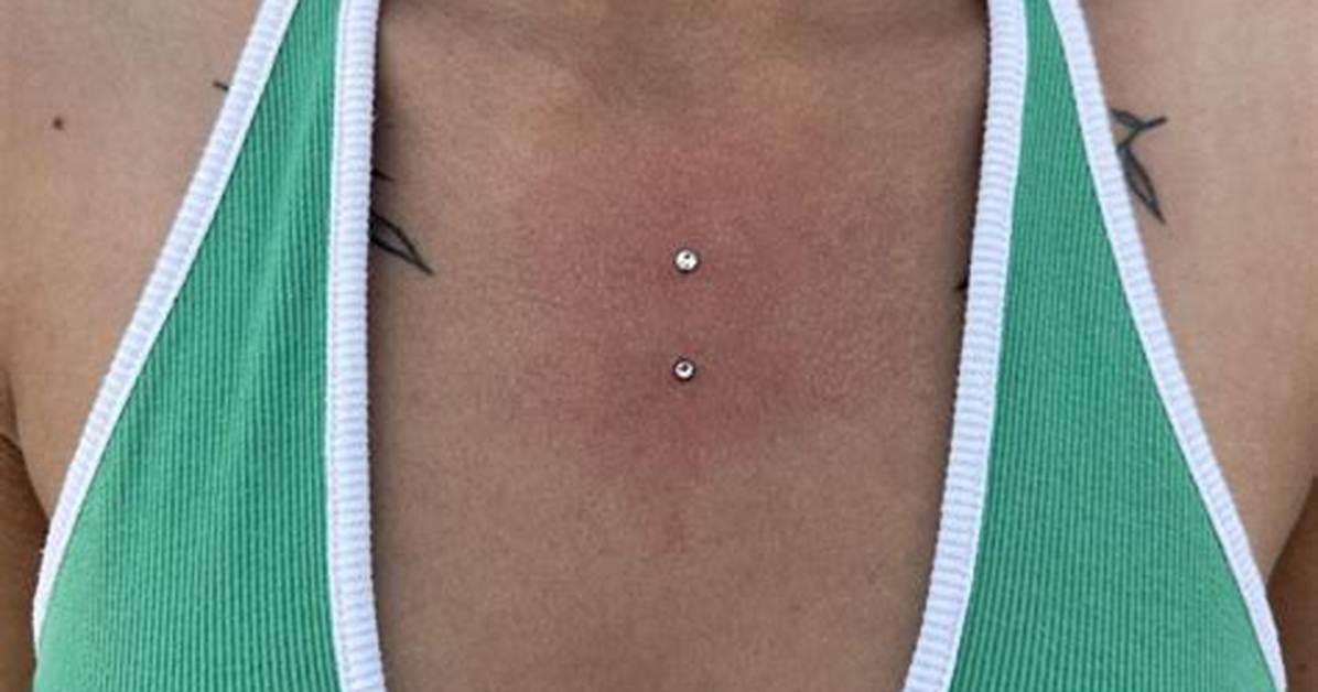 Chest Dermals