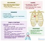 Chondrocostal