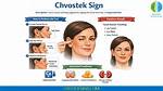 Chvostek