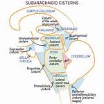 Cisterns Brain