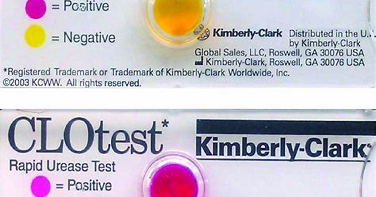 Clo Test