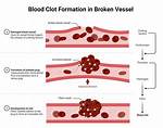 Coagulate