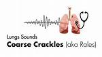 Coarse Crackles