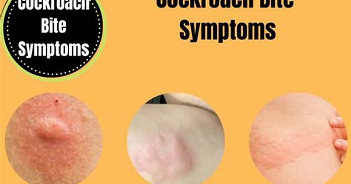Cockroach Bite Marks