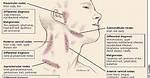 Collar Bone Lymph Nodes