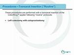 Coloproctostomy