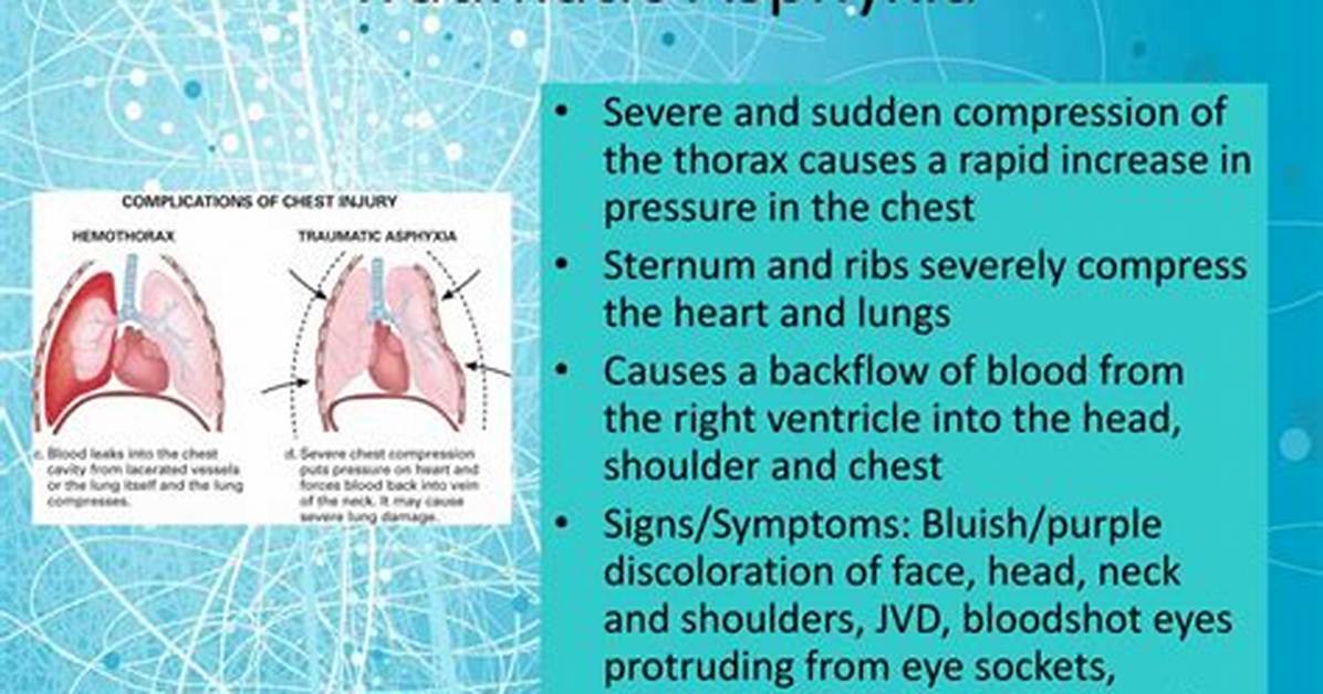 Compression Asphyxia Definition