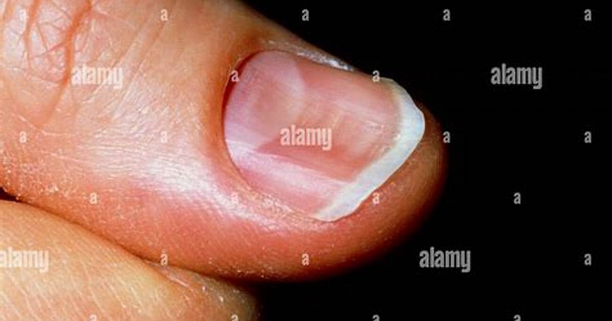 Concave Nails