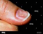 Concave Nails