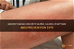 Concrete Burn