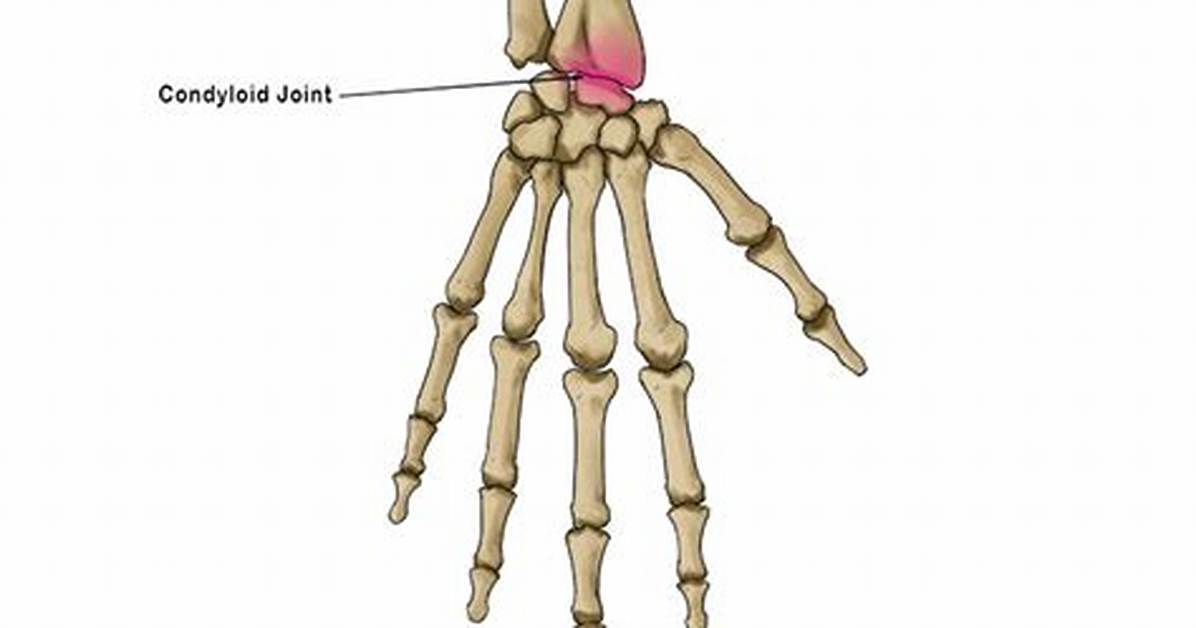 Condyloid