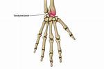 Condyloid