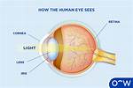 Cornea's Location