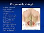 Costovertebral Angle