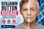 Could Benjamin Button Really Happen?