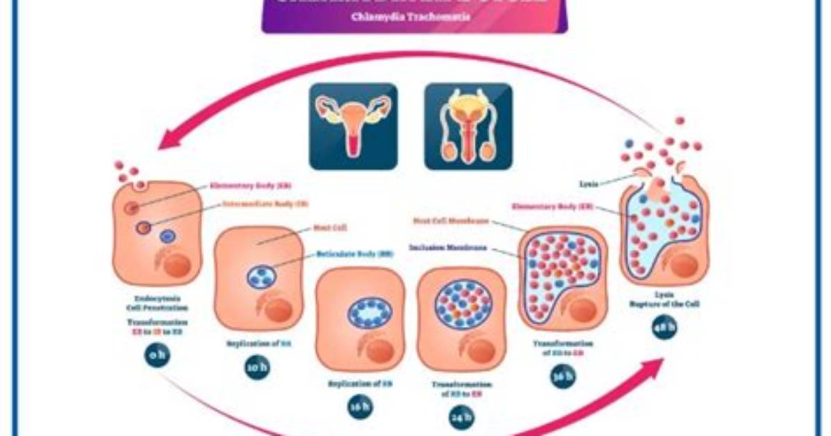 Could Chlamydia Come Back?