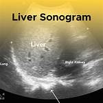 Could My Sonogram Be Wrong?