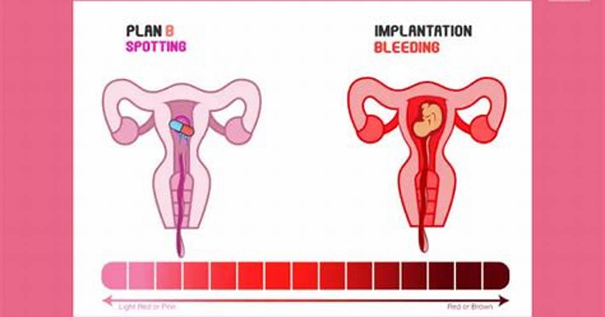 Could Plan B Cause Bleeding?