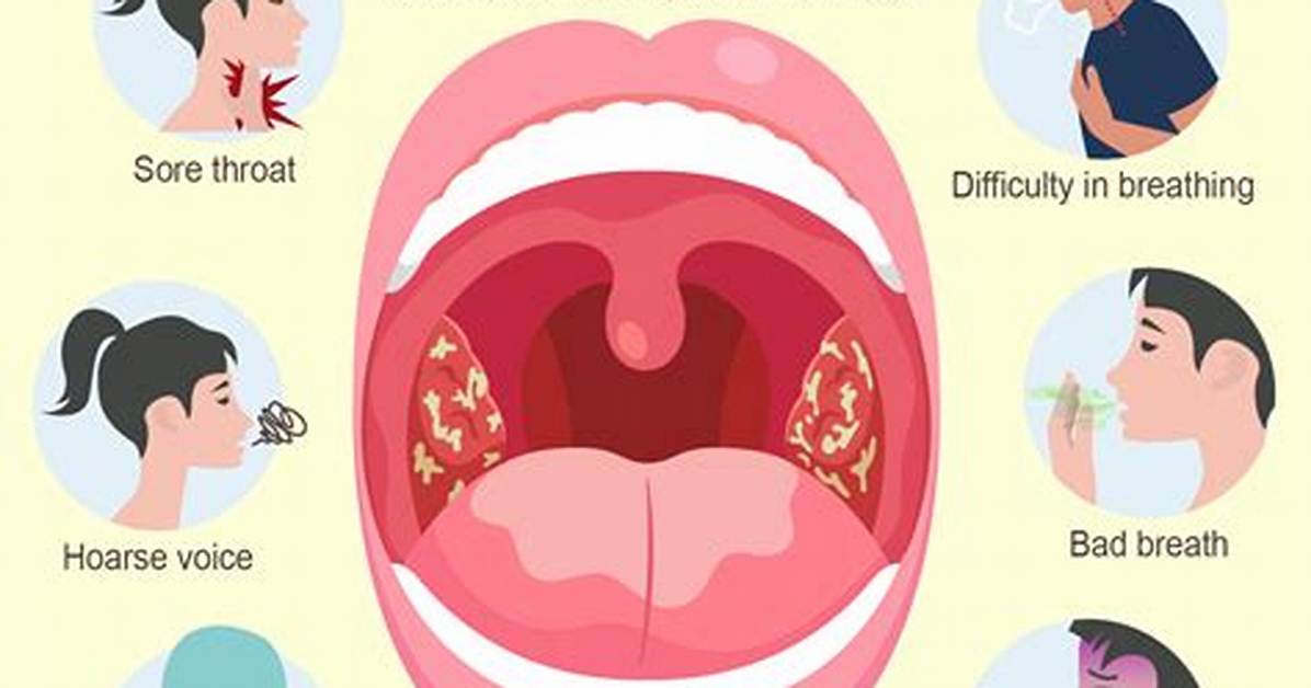 Could Tonsillitis Kill You?