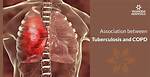 Could Tuberculosis Cause Copd?