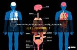 Could You Live Without a Bladder?