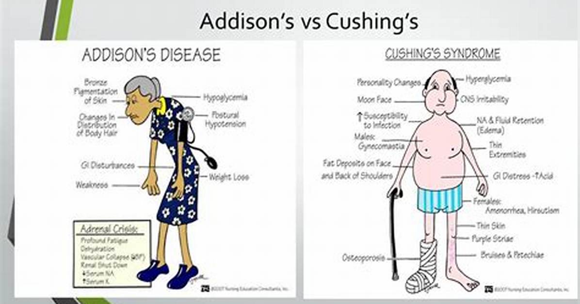 Cushing vs Addison