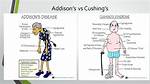 Cushing vs Addison