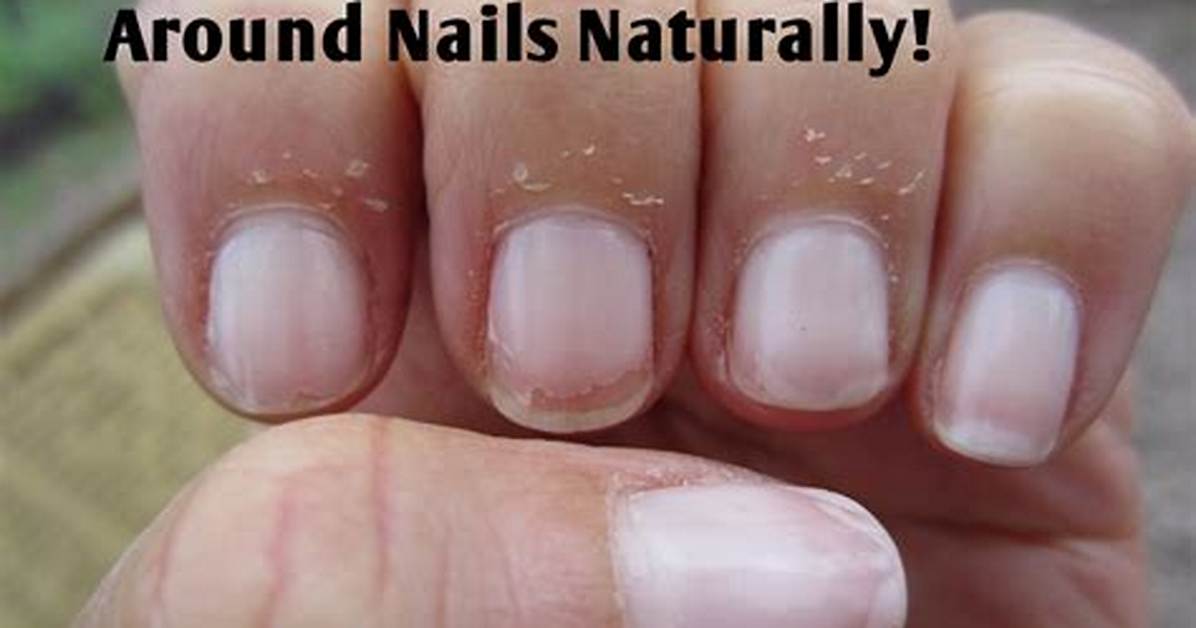 Cuticles Peeling
