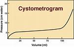 Cystometrogram