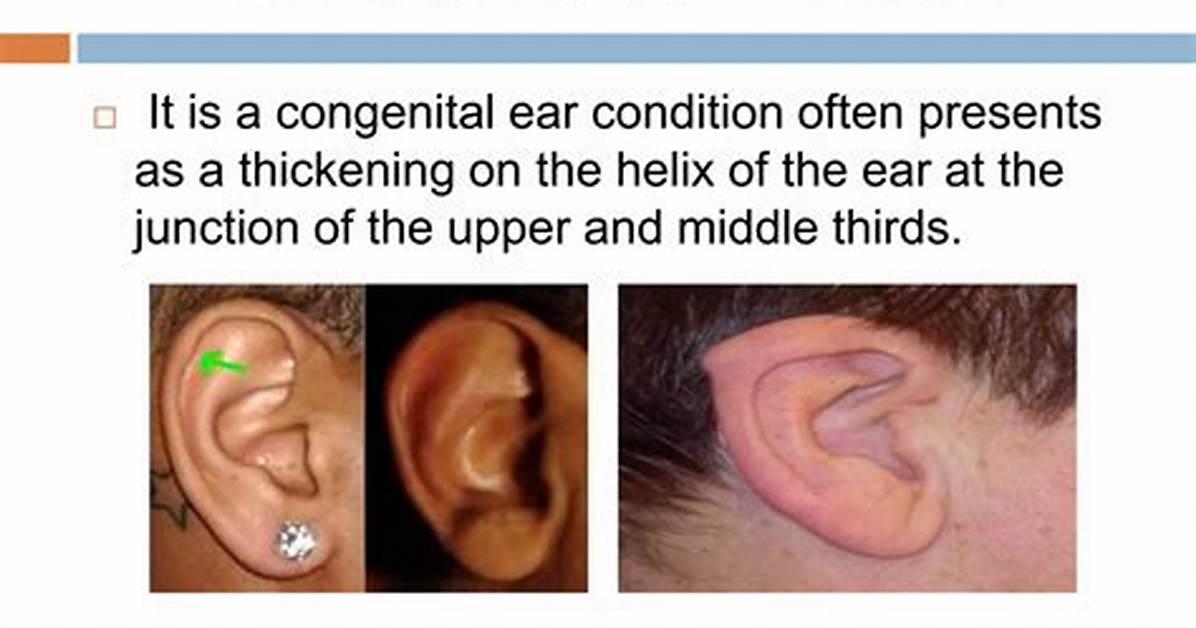 Darwin’s Tubercle