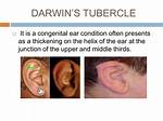 Darwin’s Tubercle
