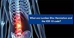 Ddd Icd 10