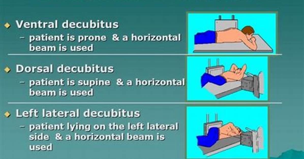Decubitus Position