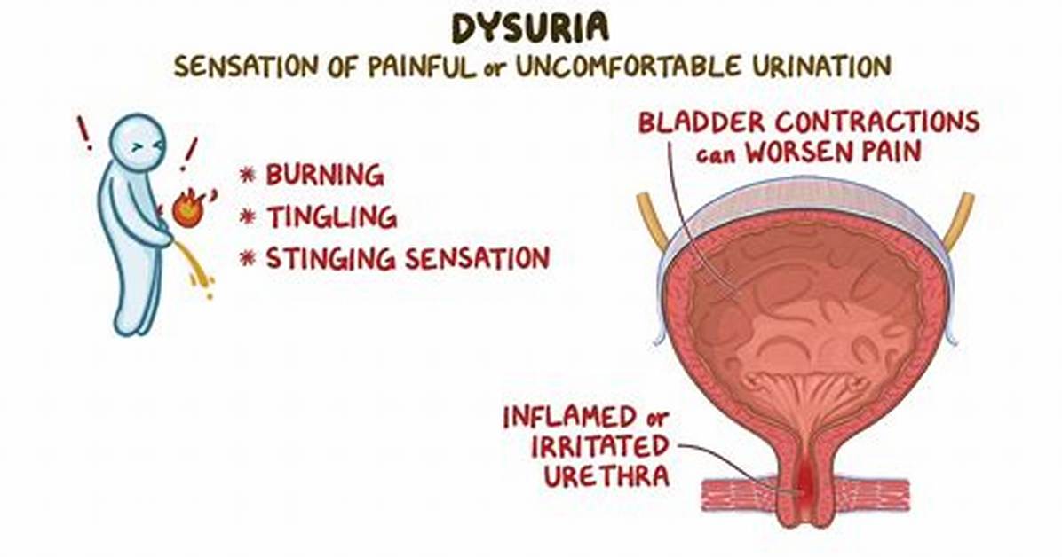 Define Dysuria