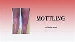 Define Mottled