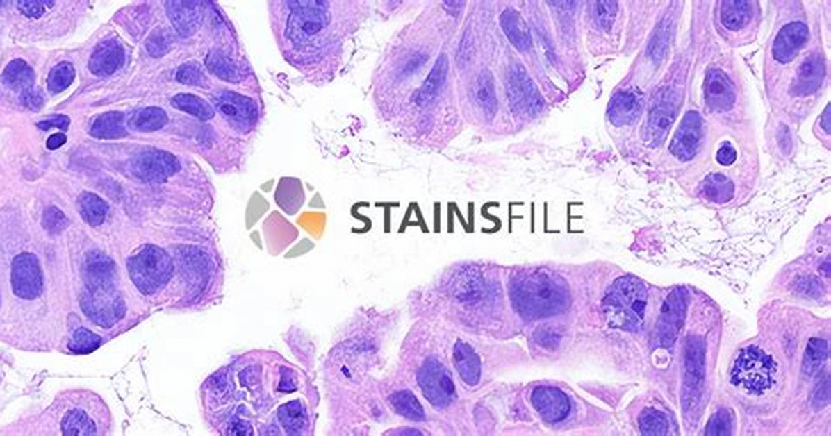 Define Stain
