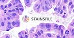 Define Stain