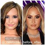 Demi Lovato Rehab -- Enters Treatment Facility Demi Lovato Quits Tour Enters Treatment Center 11/2/2010 9:30 Am Pt