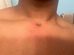 Dermal Piercing Chest