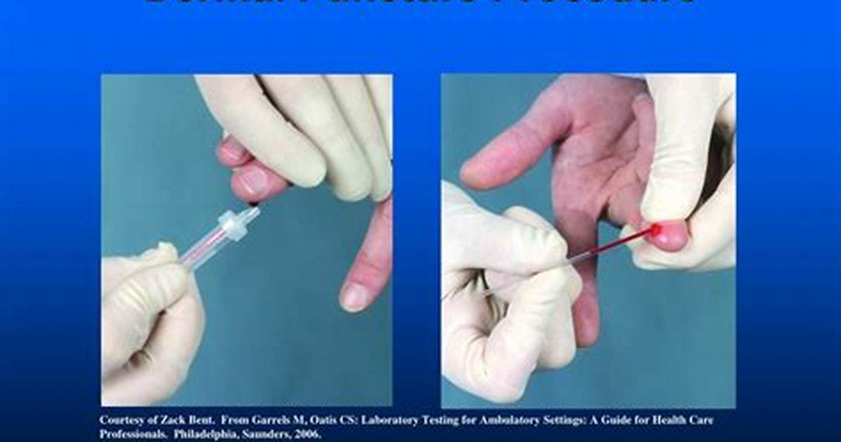 Dermal Puncture