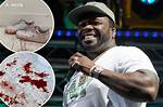 Did 50 Cent Get Shot in the Face?