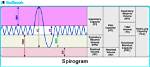 Did All the Spirogram Values Return to Normal?